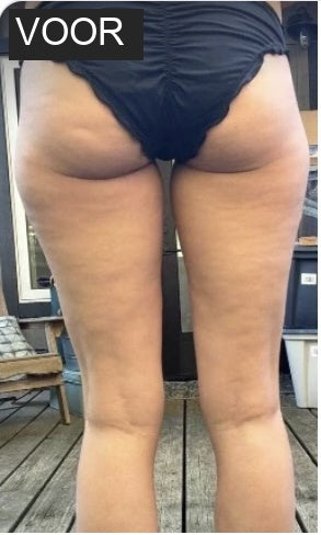 Voor